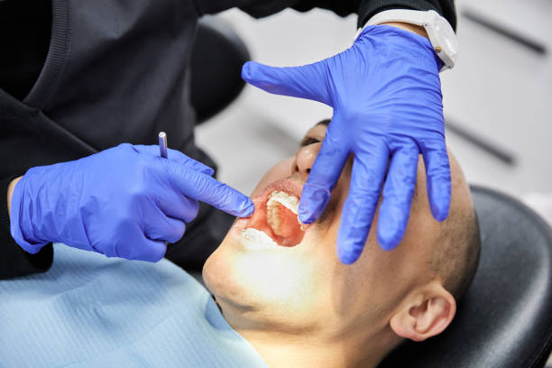 Best Dentist for Tooth Abscess  in Key Vista, FL