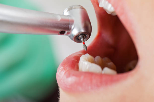 Best Emergency Dental Filling Replacement  in Key Vista, FL